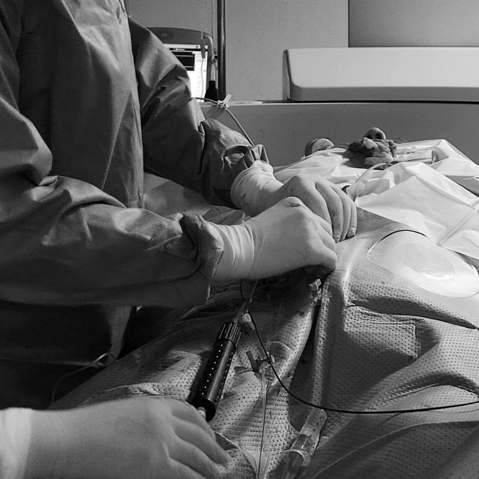 czarnobiałe zdjęcie w trakcie zabiegu angiografii